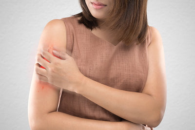 5 Common Triggers Of Psoriasis You Should Avoid
